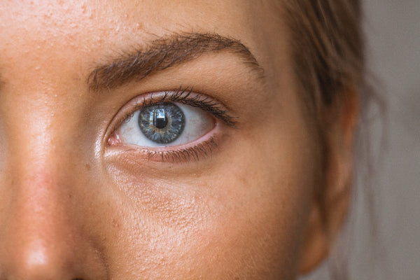 Causes and treatments for dark circles and puffy eyes.